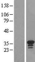 Western blot validation of overexpression lysate (Cat# LY411214) using anti-DDK antibody (Cat# TA50011-100). Left: Cell lysates from un-transfected HEK293T cells; Right: Cell lysates from HEK293T cells transfected with RC202591 using transfection reagent MegaTran 2.0 (Cat# TT210002).