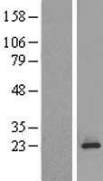 Western blot validation of overexpression lysate (Cat# LY417688) using anti-DDK antibody (Cat# TA50011-100). Left: Cell lysates from un-transfected HEK293T cells; Right: Cell lysates from HEK293T cells transfected with RC200571 using transfection reagent MegaTran 2.0 (Cat# TT210002).
