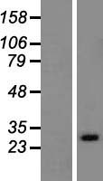 Western blot validation of overexpression lysate (Cat# LY417747) using anti-DDK antibody (Cat# TA50011-100). Left: Cell lysates from un-transfected HEK293T cells; Right: Cell lysates from HEK293T cells transfected with RC200351 using transfection reagent MegaTran 2.0 (Cat# TT210002).