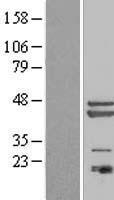 Western blot validation of overexpression lysate (Cat# LY411261) using anti-DDK antibody (Cat# TA50011-100). Left: Cell lysates from un-transfected HEK293T cells; Right: Cell lysates from HEK293T cells transfected with RC201417 using transfection reagent MegaTran 2.0 (Cat# TT210002).