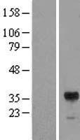 Western blot validation of overexpression lysate (Cat# LY415065) using anti-DDK antibody (Cat# TA50011-100). Left: Cell lysates from un-transfected HEK293T cells; Right: Cell lysates from HEK293T cells transfected with RC200540 using transfection reagent MegaTran 2.0 (Cat# TT210002).