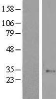 Western blot validation of overexpression lysate (Cat# LY422157) using anti-DDK antibody (Cat# TA50011-100). Left: Cell lysates from un-transfected HEK293T cells; Right: Cell lysates from HEK293T cells transfected with RC200177 using transfection reagent MegaTran 2.0 (Cat# TT210002).
