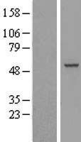Western blot validation of overexpression lysate (Cat# LY413294) using anti-DDK antibody (Cat# TA50011-100). Left: Cell lysates from un-transfected HEK293T cells; Right: Cell lysates from HEK293T cells transfected with RC200138 using transfection reagent MegaTran 2.0 (Cat# TT210002).
