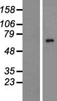 Western blot validation of overexpression lysate (Cat# LY411335) using anti-DDK antibody (Cat# TA50011-100). Left: Cell lysates from un-transfected HEK293T cells; Right: Cell lysates from HEK293T cells transfected with RC200914 using transfection reagent MegaTran 2.0 (Cat# TT210002).