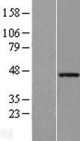 Western blot validation of overexpression lysate (Cat# LY410777) using anti-DDK antibody (Cat# TA50011-100). Left: Cell lysates from un-transfected HEK293T cells; Right: Cell lysates from HEK293T cells transfected with RC202518 using transfection reagent MegaTran 2.0 (Cat# TT210002).