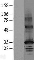 Western blot validation of overexpression lysate (Cat# LY410088) using anti-DDK antibody (Cat# TA50011-100). Left: Cell lysates from un-transfected HEK293T cells; Right: Cell lysates from HEK293T cells transfected with RC202646 using transfection reagent MegaTran 2.0 (Cat# TT210002).