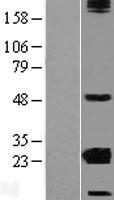 Western blot validation of overexpression lysate (Cat# LY409256) using anti-DDK antibody (Cat# TA50011-100). Left: Cell lysates from un-transfected HEK293T cells; Right: Cell lysates from HEK293T cells transfected with RC223668 using transfection reagent MegaTran 2.0 (Cat# TT210002).