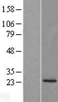 Western blot validation of overexpression lysate (Cat# LY410218) using anti-DDK antibody (Cat# TA50011-100). Left: Cell lysates from un-transfected HEK293T cells; Right: Cell lysates from HEK293T cells transfected with RC202972 using transfection reagent MegaTran 2.0 (Cat# TT210002).