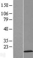 Western blot validation of overexpression lysate (Cat# LY409126) using anti-DDK antibody (Cat# TA50011-100). Left: Cell lysates from un-transfected HEK293T cells; Right: Cell lysates from HEK293T cells transfected with RC202976 using transfection reagent MegaTran 2.0 (Cat# TT210002).