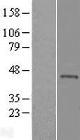 Western blot validation of overexpression lysate (Cat# LY409263) using anti-DDK antibody (Cat# TA50011-100). Left: Cell lysates from un-transfected HEK293T cells; Right: Cell lysates from HEK293T cells transfected with RC203552 using transfection reagent MegaTran 2.0 (Cat# TT210002).