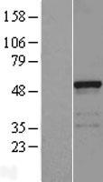 Western blot validation of overexpression lysate (Cat# LY408640) using anti-DDK antibody (Cat# TA50011-100). Left: Cell lysates from un-transfected HEK293T cells; Right: Cell lysates from HEK293T cells transfected with RC203593 using transfection reagent MegaTran 2.0 (Cat# TT210002).