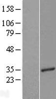 Western blot validation of overexpression lysate (Cat# LY409871) using anti-DDK antibody (Cat# TA50011-100). Left: Cell lysates from un-transfected HEK293T cells; Right: Cell lysates from HEK293T cells transfected with RC218119 using transfection reagent MegaTran 2.0 (Cat# TT210002).