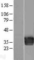 Western blot validation of overexpression lysate (Cat# LY400036) using anti-DDK antibody (Cat# TA50011-100). Left: Cell lysates from un-transfected HEK293T cells; Right: Cell lysates from HEK293T cells transfected with RC220053 using transfection reagent MegaTran 2.0 (Cat# TT210002).