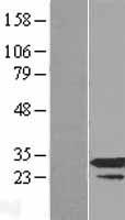 Western blot validation of overexpression lysate (Cat# LY416661) using anti-DDK antibody (Cat# TA50011-100). Left: Cell lysates from un-transfected HEK293T cells; Right: Cell lysates from HEK293T cells transfected with RC202686 using transfection reagent MegaTran 2.0 (Cat# TT210002).