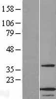 Western blot validation of overexpression lysate (Cat# LY414554) using anti-DDK antibody (Cat# TA50011-100). Left: Cell lysates from un-transfected HEK293T cells; Right: Cell lysates from HEK293T cells transfected with RC202815 using transfection reagent MegaTran 2.0 (Cat# TT210002).