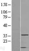 Western blot validation of overexpression lysate (Cat# LY416843) using anti-DDK antibody (Cat# TA50011-100). Left: Cell lysates from un-transfected HEK293T cells; Right: Cell lysates from HEK293T cells transfected with RC202764 using transfection reagent MegaTran 2.0 (Cat# TT210002).