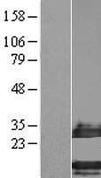 Western blot validation of overexpression lysate (Cat# LY406403) using anti-DDK antibody (Cat# TA50011-100). Left: Cell lysates from un-transfected HEK293T cells; Right: Cell lysates from HEK293T cells transfected with RC203349 using transfection reagent MegaTran 2.0 (Cat# TT210002).