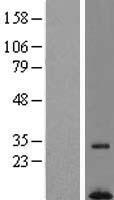 Western blot validation of overexpression lysate (Cat# LY405079) using anti-DDK antibody (Cat# TA50011-100). Left: Cell lysates from un-transfected HEK293T cells; Right: Cell lysates from HEK293T cells transfected with RC203326 using transfection reagent MegaTran 2.0 (Cat# TT210002).