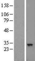 Western blot validation of overexpression lysate (Cat# LY417751) using anti-DDK antibody (Cat# TA50011-100). Left: Cell lysates from un-transfected HEK293T cells; Right: Cell lysates from HEK293T cells transfected with RC200225 using transfection reagent MegaTran 2.0 (Cat# TT210002).