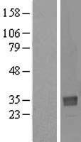 Western blot validation of overexpression lysate (Cat# LY406607) using anti-DDK antibody (Cat# TA50011-100). Left: Cell lysates from un-transfected HEK293T cells; Right: Cell lysates from HEK293T cells transfected with RC205697 using transfection reagent MegaTran 2.0 (Cat# TT210002).