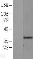 Western blot validation of overexpression lysate (Cat# LY408522) using anti-DDK antibody (Cat# TA50011-100). Left: Cell lysates from un-transfected HEK293T cells; Right: Cell lysates from HEK293T cells transfected with RC204800 using transfection reagent MegaTran 2.0 (Cat# TT210002).