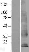 Western blot validation of overexpression lysate (Cat# LY408523) using anti-DDK antibody (Cat# TA50011-100). Left: Cell lysates from un-transfected HEK293T cells; Right: Cell lysates from HEK293T cells transfected with RC205029 using transfection reagent MegaTran 2.0 (Cat# TT210002).