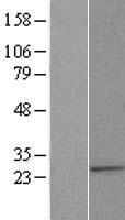 Western blot validation of overexpression lysate (Cat# LY408127) using anti-DDK antibody (Cat# TA50011-100). Left: Cell lysates from un-transfected HEK293T cells; Right: Cell lysates from HEK293T cells transfected with RC204062 using transfection reagent MegaTran 2.0 (Cat# TT210002).