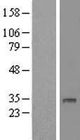 Western blot validation of overexpression lysate (Cat# LY422169) using anti-DDK antibody (Cat# TA50011-100). Left: Cell lysates from un-transfected HEK293T cells; Right: Cell lysates from HEK293T cells transfected with RC203383 using transfection reagent MegaTran 2.0 (Cat# TT210002).