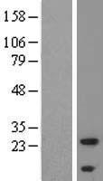 Western blot validation of overexpression lysate (Cat# LY407950) using anti-DDK antibody (Cat# TA50011-100). Left: Cell lysates from un-transfected HEK293T cells; Right: Cell lysates from HEK293T cells transfected with RC204940 using transfection reagent MegaTran 2.0 (Cat# TT210002).