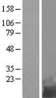 Western blot validation of overexpression lysate (Cat# LY415442) using anti-DDK antibody (Cat# TA50011-100). Left: Cell lysates from un-transfected HEK293T cells; Right: Cell lysates from HEK293T cells transfected with RC204821 using transfection reagent MegaTran 2.0 (Cat# TT210002).