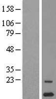 Western blot validation of overexpression lysate (Cat# LY410050) using anti-DDK antibody (Cat# TA50011-100). Left: Cell lysates from un-transfected HEK293T cells; Right: Cell lysates from HEK293T cells transfected with RC204813 using transfection reagent MegaTran 2.0 (Cat# TT210002).