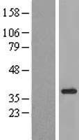 Western blot validation of overexpression lysate (Cat# LY412452) using anti-DDK antibody (Cat# TA50011-100). Left: Cell lysates from un-transfected HEK293T cells; Right: Cell lysates from HEK293T cells transfected with RC218066 using transfection reagent MegaTran 2.0 (Cat# TT210002).