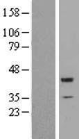 Western blot validation of overexpression lysate (Cat# LY407334) using anti-DDK antibody (Cat# TA50011-100). Left: Cell lysates from un-transfected HEK293T cells; Right: Cell lysates from HEK293T cells transfected with RC200904 using transfection reagent MegaTran 2.0 (Cat# TT210002).