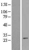 Western blot validation of overexpression lysate (Cat# LY408597) using anti-DDK antibody (Cat# TA50011-100). Left: Cell lysates from un-transfected HEK293T cells; Right: Cell lysates from HEK293T cells transfected with RC204263 using transfection reagent MegaTran 2.0 (Cat# TT210002).