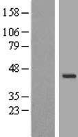 Western blot validation of overexpression lysate (Cat# LY407976) using anti-DDK antibody (Cat# TA50011-100). Left: Cell lysates from un-transfected HEK293T cells; Right: Cell lysates from HEK293T cells transfected with RC224387 using transfection reagent MegaTran 2.0 (Cat# TT210002).