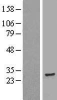 Western blot validation of overexpression lysate (Cat# LY414582) using anti-DDK antibody (Cat# TA50011-100). Left: Cell lysates from un-transfected HEK293T cells; Right: Cell lysates from HEK293T cells transfected with RC204141 using transfection reagent MegaTran 2.0 (Cat# TT210002).