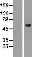 Western blot validation of overexpression lysate (Cat# LY415217) using anti-DDK antibody (Cat# TA50011-100). Left: Cell lysates from un-transfected HEK293T cells; Right: Cell lysates from HEK293T cells transfected with RC204121 using transfection reagent MegaTran 2.0 (Cat# TT210002).