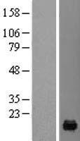 Western blot validation of overexpression lysate (Cat# LY419198) using anti-DDK antibody (Cat# TA50011-100). Left: Cell lysates from un-transfected HEK293T cells; Right: Cell lysates from HEK293T cells transfected with RC203137 using transfection reagent MegaTran 2.0 (Cat# TT210002).