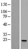 Western blot validation of overexpression lysate (Cat# LY416945) using anti-DDK antibody (Cat# TA50011-100). Left: Cell lysates from un-transfected HEK293T cells; Right: Cell lysates from HEK293T cells transfected with RC203105 using transfection reagent MegaTran 2.0 (Cat# TT210002).