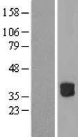 Western blot validation of overexpression lysate (Cat# LY413791) using anti-DDK antibody (Cat# TA50011-100). Left: Cell lysates from un-transfected HEK293T cells; Right: Cell lysates from HEK293T cells transfected with RC203057 using transfection reagent MegaTran 2.0 (Cat# TT210002).
