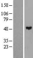 Western blot validation of overexpression lysate (Cat# LY416741) using anti-DDK antibody (Cat# TA50011-100). Left: Cell lysates from un-transfected HEK293T cells; Right: Cell lysates from HEK293T cells transfected with RC203099 using transfection reagent MegaTran 2.0 (Cat# TT210002).