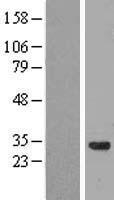 Western blot validation of overexpression lysate (Cat# LY414219) using anti-DDK antibody (Cat# TA50011-100). Left: Cell lysates from un-transfected HEK293T cells; Right: Cell lysates from HEK293T cells transfected with RC203045 using transfection reagent MegaTran 2.0 (Cat# TT210002).