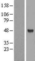 Western blot validation of overexpression lysate (Cat# LY409737) using anti-DDK antibody (Cat# TA50011-100). Left: Cell lysates from un-transfected HEK293T cells; Right: Cell lysates from HEK293T cells transfected with RC204766 using transfection reagent MegaTran 2.0 (Cat# TT210002).