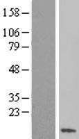 Western blot validation of overexpression lysate (Cat# LY414076) using anti-DDK antibody (Cat# TA50011-100). Left: Cell lysates from un-transfected HEK293T cells; Right: Cell lysates from HEK293T cells transfected with RC204667 using transfection reagent MegaTran 2.0 (Cat# TT210002).