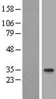 Western blot validation of overexpression lysate (Cat# LY411264) using anti-DDK antibody (Cat# TA50011-100). Left: Cell lysates from un-transfected HEK293T cells; Right: Cell lysates from HEK293T cells transfected with RC205054 using transfection reagent MegaTran 2.0 (Cat# TT210002).