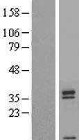 Western blot validation of overexpression lysate (Cat# LY405755) using anti-DDK antibody (Cat# TA50011-100). Left: Cell lysates from un-transfected HEK293T cells; Right: Cell lysates from HEK293T cells transfected with RC221352 using transfection reagent MegaTran 2.0 (Cat# TT210002).