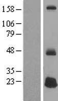 Western blot validation of overexpression lysate (Cat# LY407046) using anti-DDK antibody (Cat# TA50011-100). Left: Cell lysates from un-transfected HEK293T cells; Right: Cell lysates from HEK293T cells transfected with RC212030 using transfection reagent MegaTran 2.0 (Cat# TT210002).