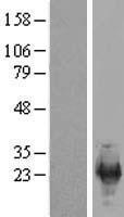 Western blot validation of overexpression lysate (Cat# LY406434) using anti-DDK antibody (Cat# TA50011-100). Left: Cell lysates from un-transfected HEK293T cells; Right: Cell lysates from HEK293T cells transfected with RC219746 using transfection reagent MegaTran 2.0 (Cat# TT210002).