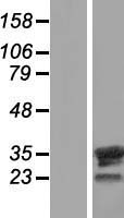 Western blot validation of overexpression lysate (Cat# LY404199) using anti-DDK antibody (Cat# TA50011-100). Left: Cell lysates from un-transfected HEK293T cells; Right: Cell lysates from HEK293T cells transfected with RC213736 using transfection reagent MegaTran 2.0 (Cat# TT210002).