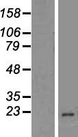 Western blot validation of overexpression lysate (Cat# LY404512) using anti-DDK antibody (Cat# TA50011-100). Left: Cell lysates from un-transfected HEK293T cells; Right: Cell lysates from HEK293T cells transfected with RC221922 using transfection reagent MegaTran 2.0 (Cat# TT210002).